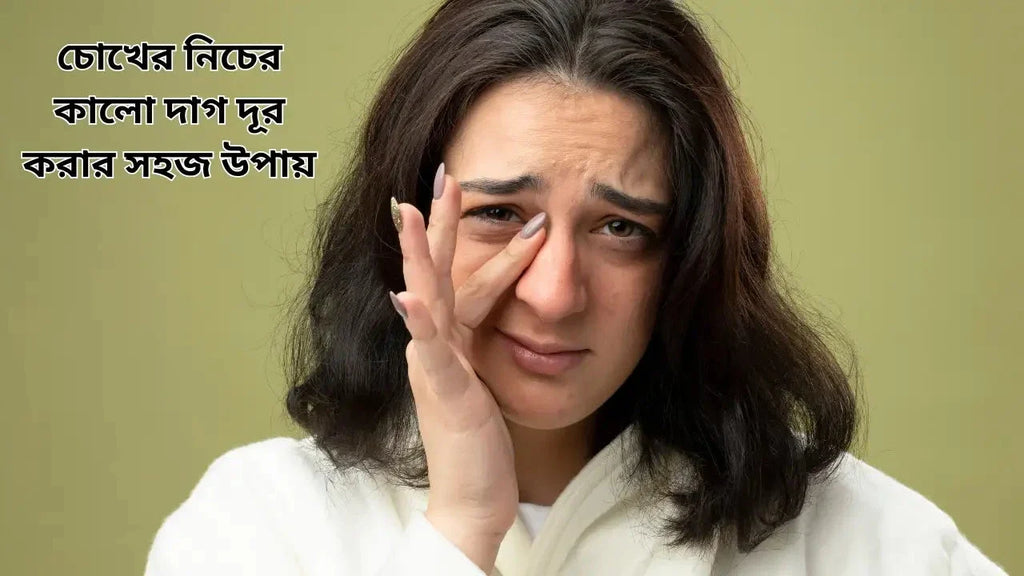 ৯ দিনেই চোখের নিচের কালো দাগ দূর করার সহজ উপায়