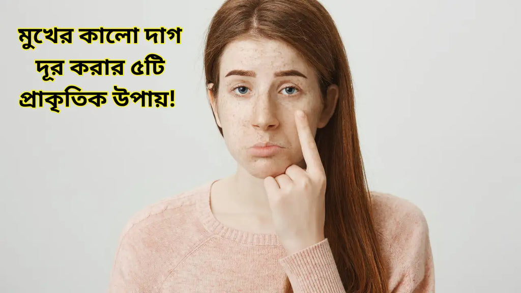 মুখের কালো দাগ দূর করার ৫টি প্রাকৃতিক উপায়!