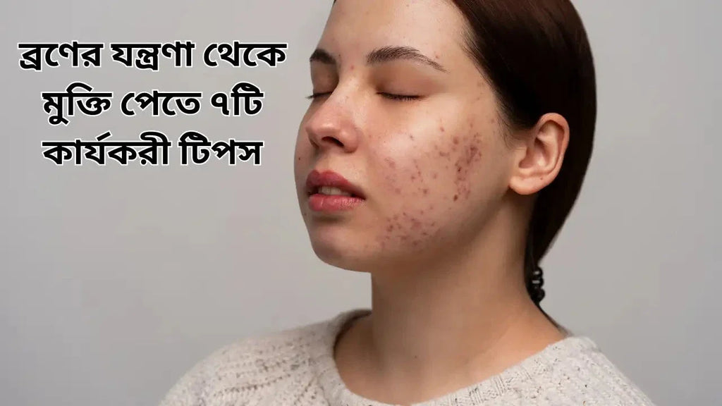 ব্রণের যন্ত্রণা থেকে মুক্তি পেতে ৭টি কার্যকরী টিপস