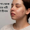 ব্রণের যন্ত্রণা থেকে মুক্তি পেতে ৭টি কার্যকরী টিপস