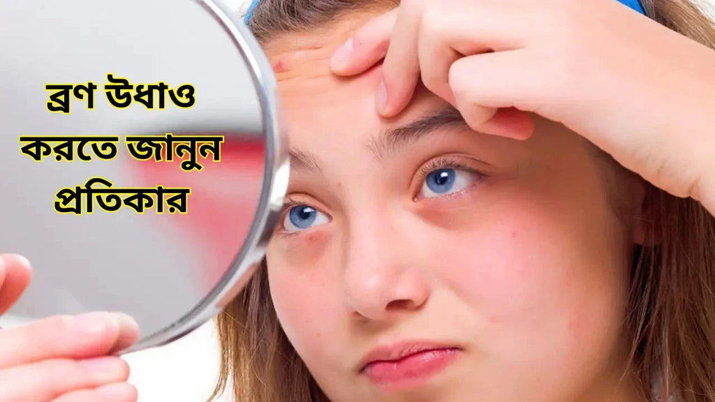 কপালে ব্রণ? ৭ দিনেই ব্রণ উধাও করতে জানুন প্রতিকার!