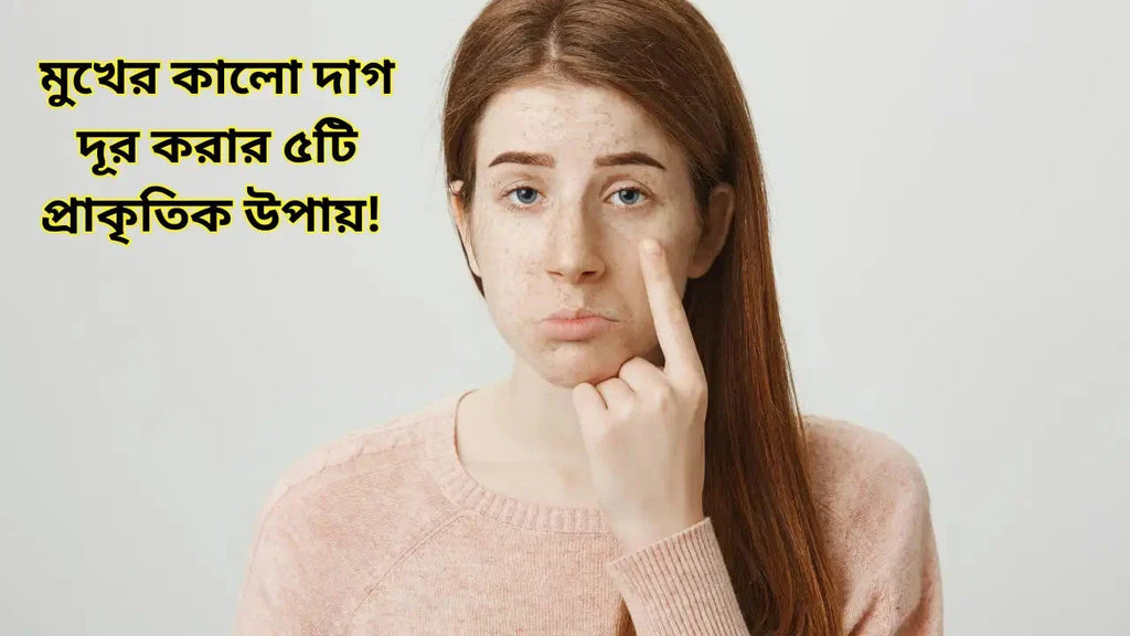 মুখের কালো দাগ দূর করার ৫টি প্রাকৃতিক উপায়!