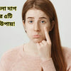 মুখের কালো দাগ দূর করার ৫টি প্রাকৃতিক উপায়!
