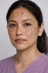 Dark Spots