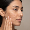 Dark Spots